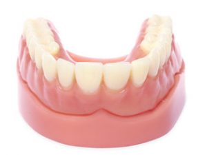 acrylic-denture-stabilized-300x225 Removable Acrylic Overdenture mini dental implants Emeryville