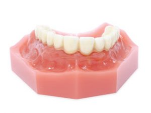 fix-on-six-300x225 Semi-Removable Hybrid Resin or Zirconia mini dental implants Emeryville